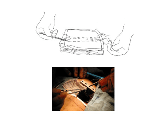 Seed-Embedded Mesh